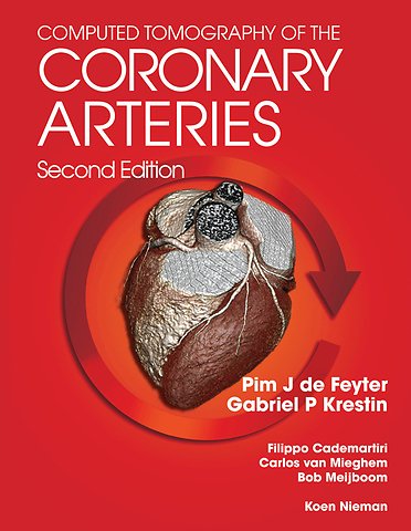 Computed Tomography of the Coronary Arteries