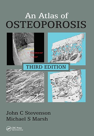 Atlas of Osteoporosis