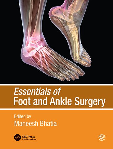 Essentials of Foot and Ankle Surgery