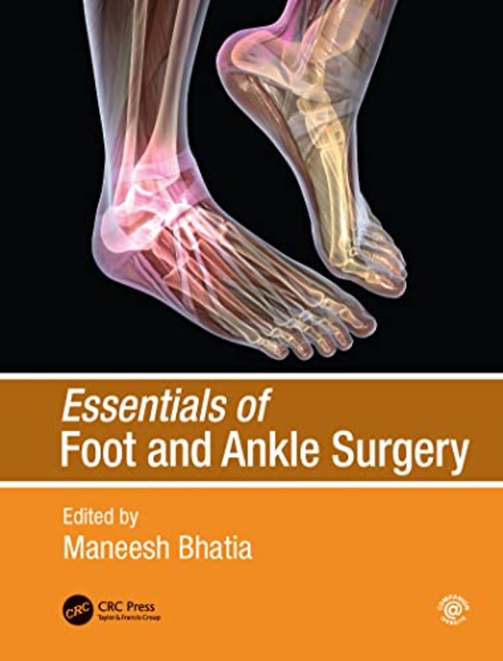 Essentials of Foot and Ankle Surgery