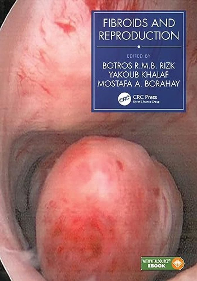 Fibroids and Reproduction