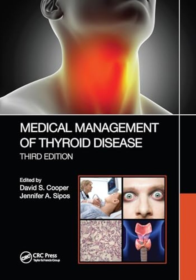 Medical Management of Thyroid Disease, Third Edition