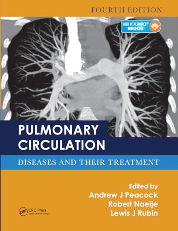 Pulmonary Circulation