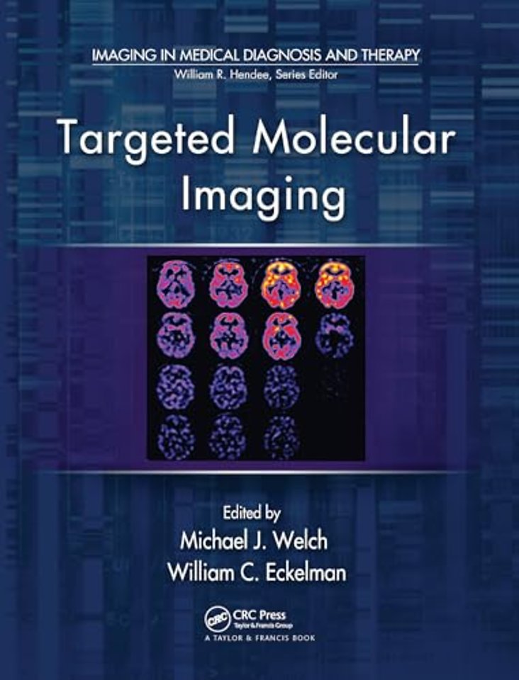 Targeted Molecular Imaging