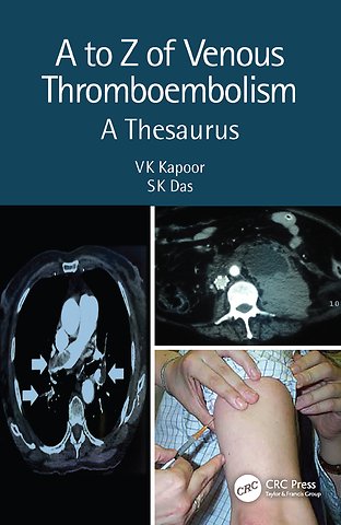 to Z of Venous Thromboembolism