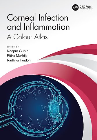Corneal Infection and Inflammation