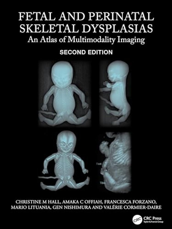Fetal and Perinatal Skeletal Dysplasias