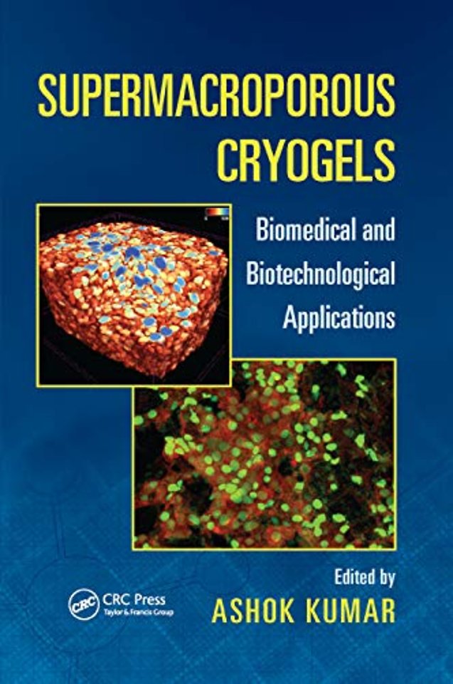 Supermacroporous Cryogels
