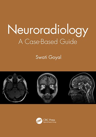 Neuroradiology