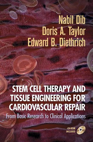 Stem Cell Therapy and Tissue Engineering for Cardiovascular Repair