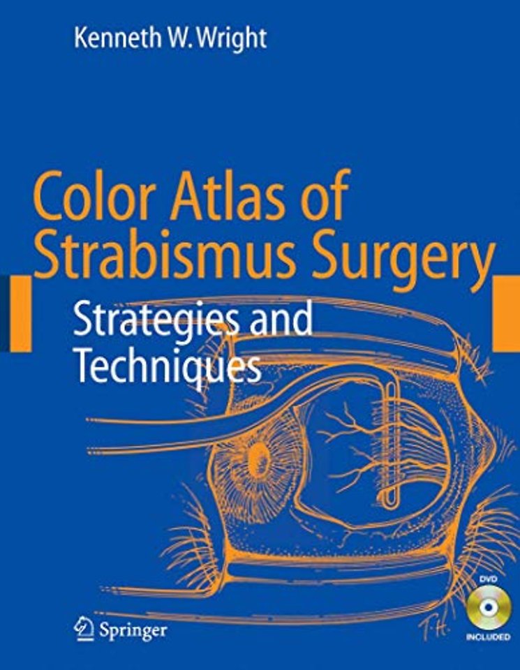 Color Atlas of Strabismus Surgery
