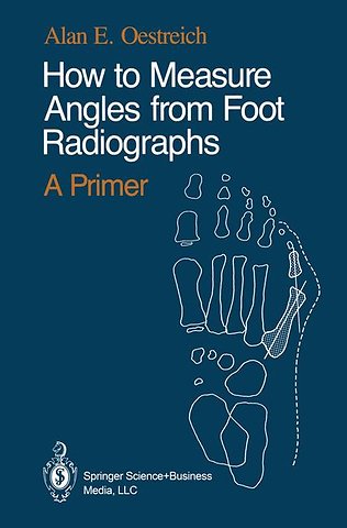 How to Measure Angles from Foot Radiographs