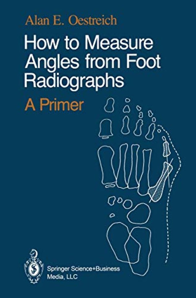 How to Measure Angles from Foot Radiographs