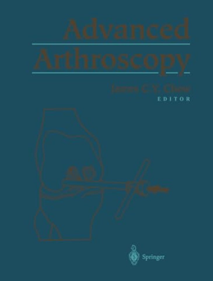 Advanced Arthroscopy