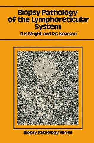 Biopsy Pathology of the Lymphoreticular System
