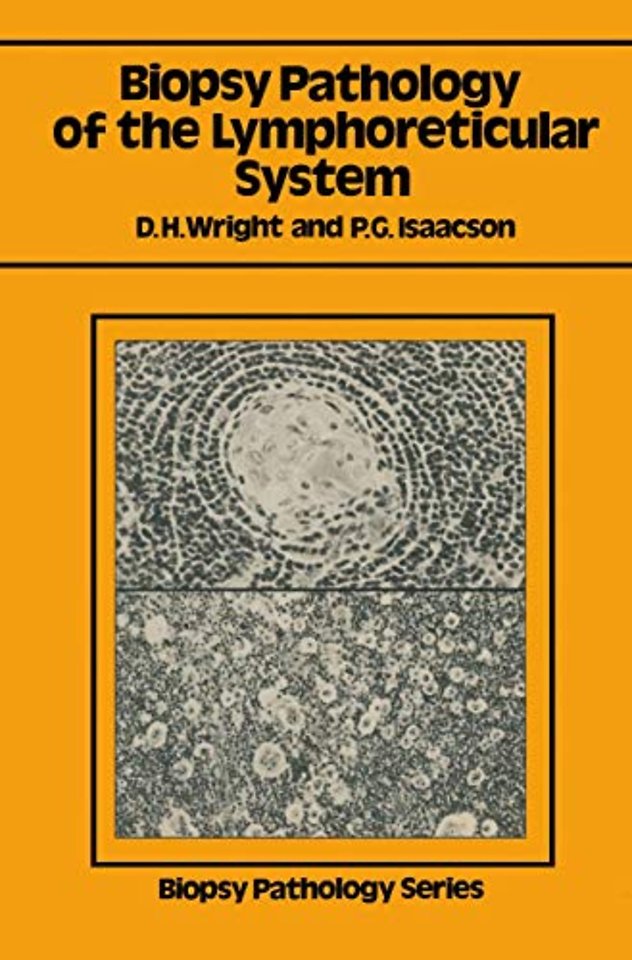 Biopsy Pathology of the Lymphoreticular System
