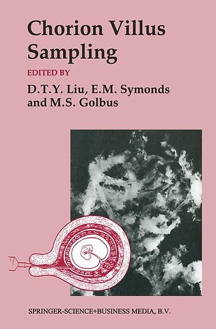 Chorion Villus Sampling