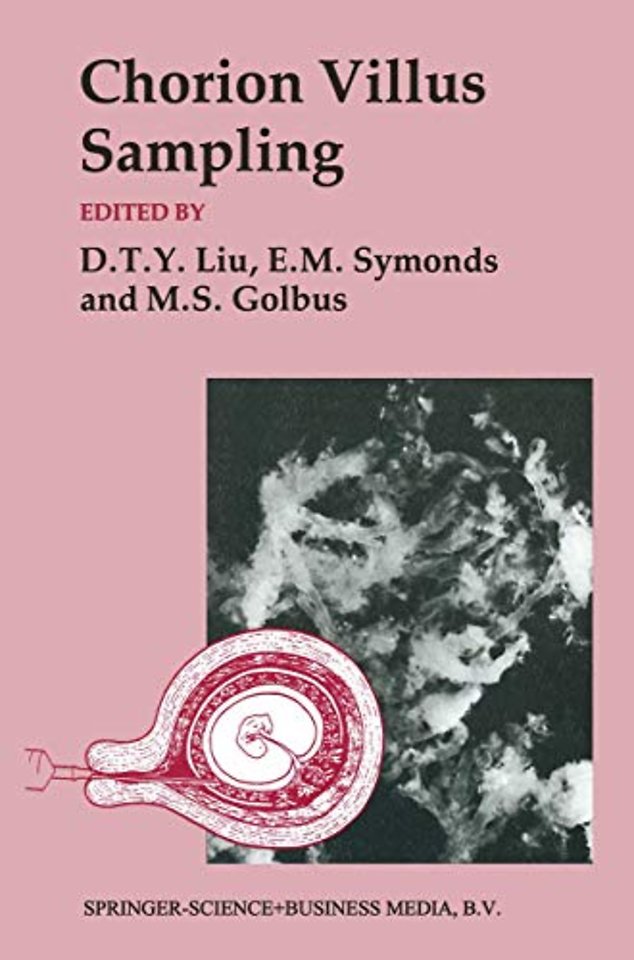 Chorion Villus Sampling