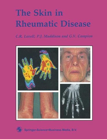 The Skin in Rheumatic Disease