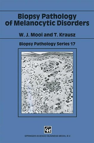 Biopsy Pathology of Melanocytic Disorders