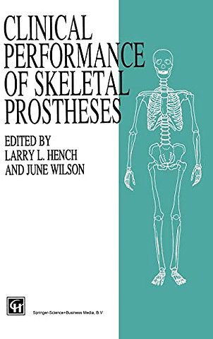 Clinical Performance of Skeletal Prostheses