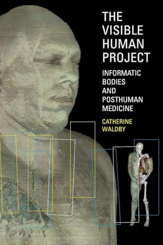 Visible Human Project