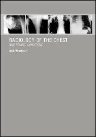 Radiology of the Chest and Related Conditions
