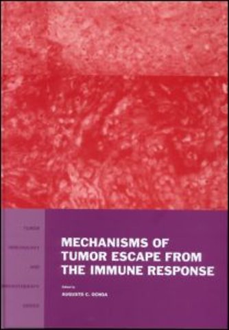 Mechanisms of Tumor Escape from the Immune Response
