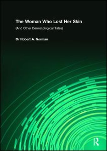 Woman Who Lost Her Skin