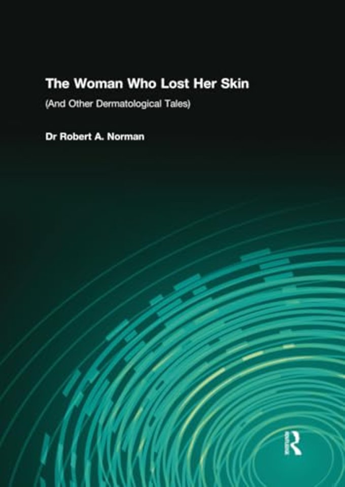 Woman Who Lost Her Skin