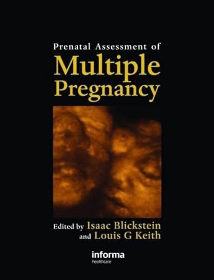 Prenatal Assessment of Multiple Pregnancy