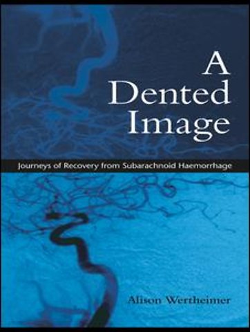 Dented Image