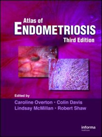 Atlas of Endometriosis