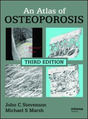 Atlas of Osteoporosis