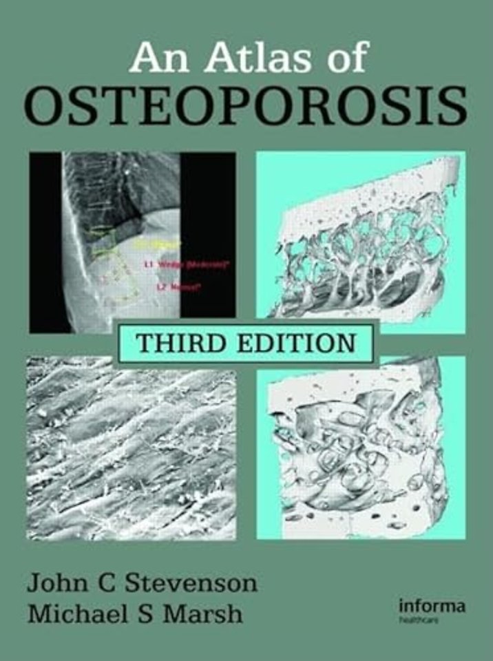 Atlas of Osteoporosis