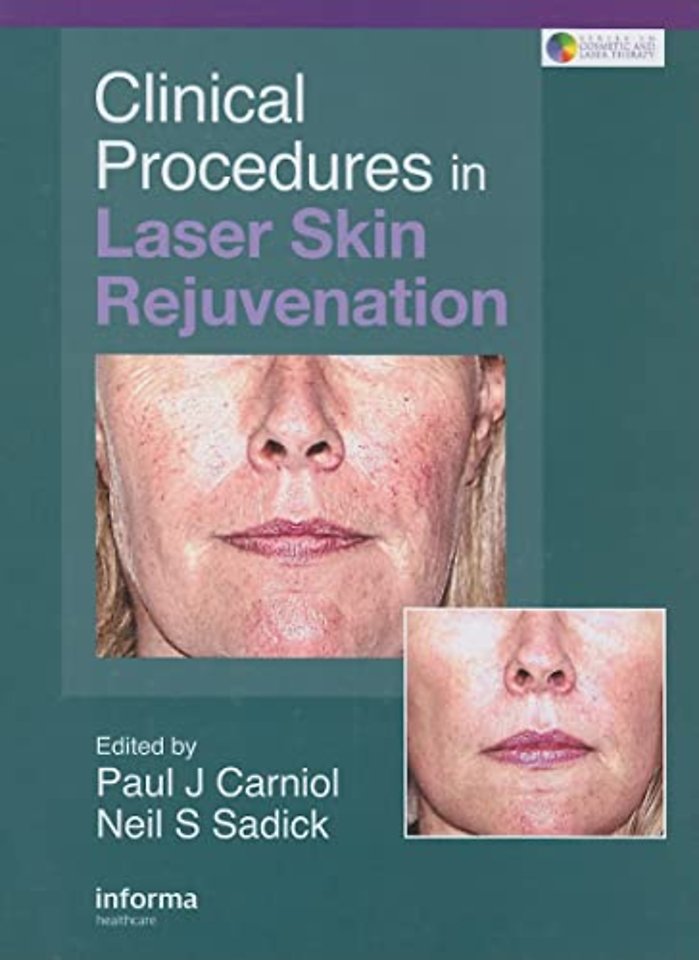 Clinical Procedures in Laser Skin Rejuvenation
