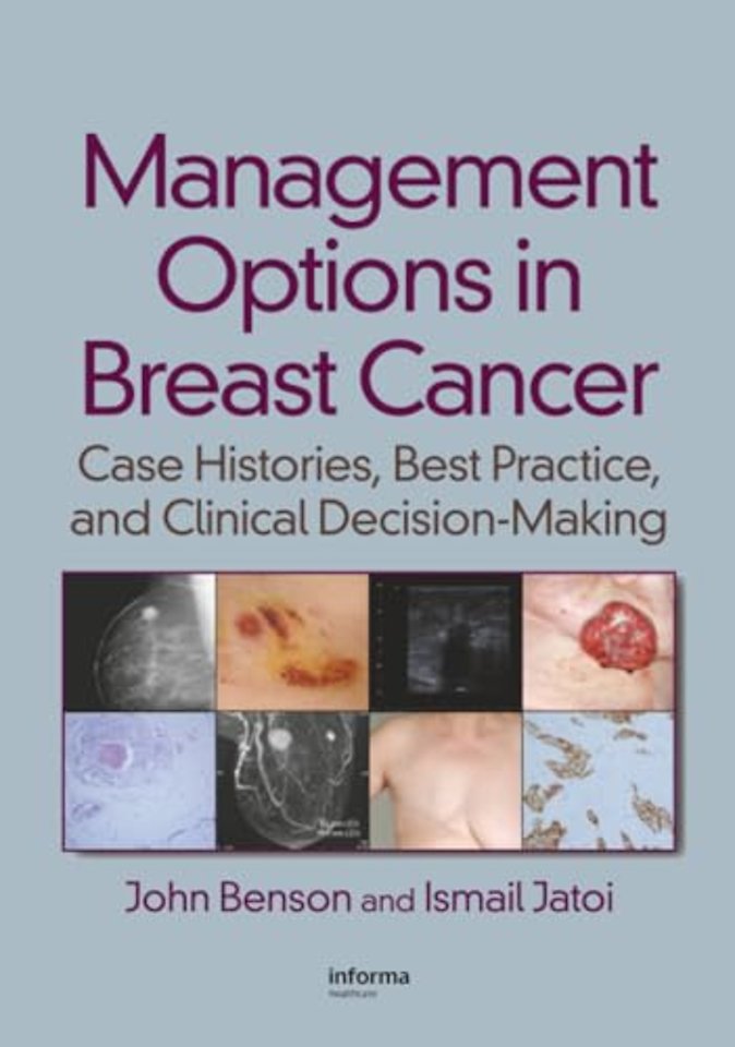Management Options in Breast Cancer