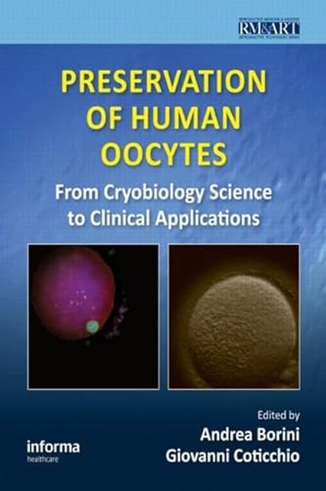 Preservation of Human Oocytes