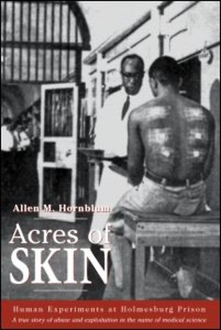 Acres of Skin