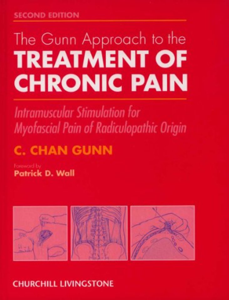 The Gunn Approach to the Treatment of Chronic Pain
