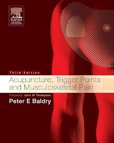 Acupuncture, Trigger Points and Musculoskeletal Pain