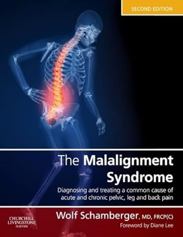 The Malalignment Syndrome