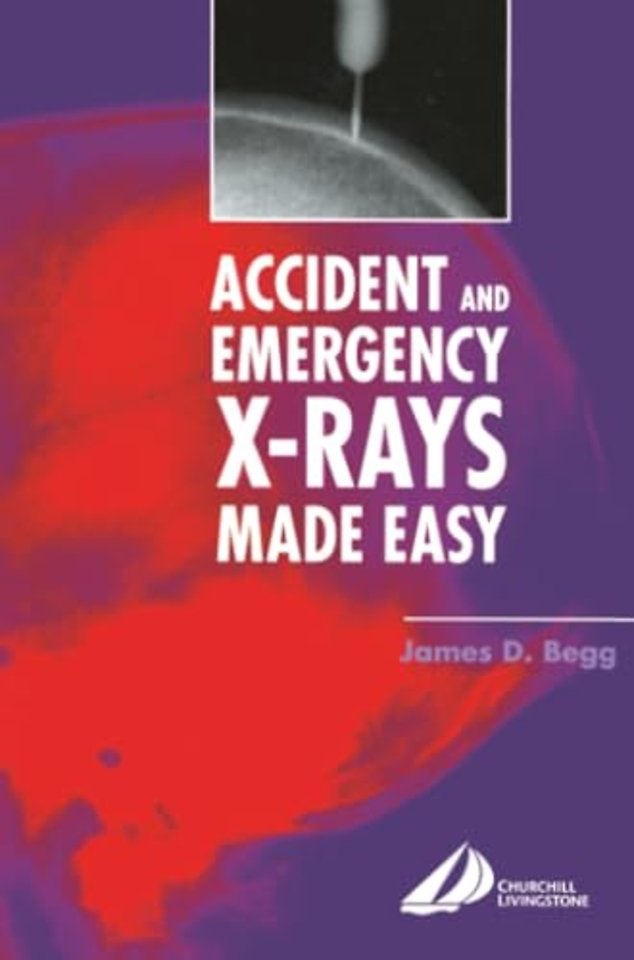Accident and Emergency X-Rays Made Easy