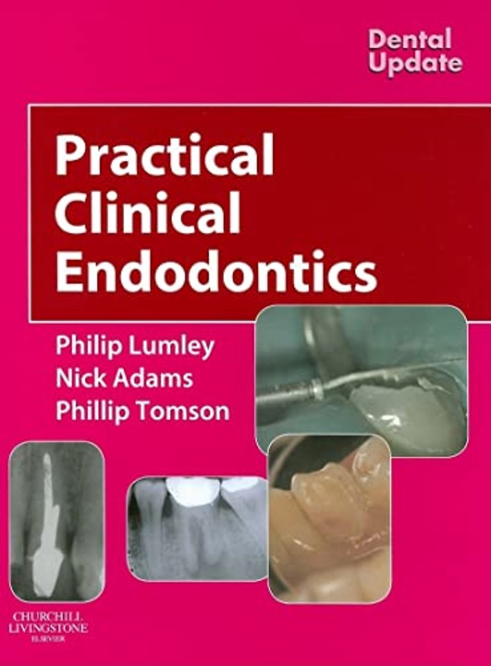 Practical Clinical Endodontics
