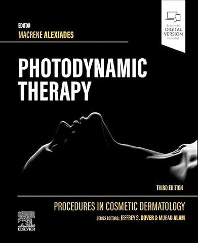 Procedures in Cosmetic Dermatology Series: Photodynamic Therapy