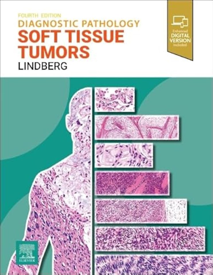 Diagnostic Pathology: Soft Tissue Tumors