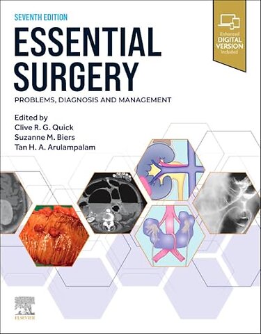 Essential Surgery