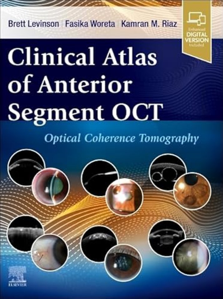 Clinical Atlas of Anterior Segment OCT: Optical Coherence Tomography