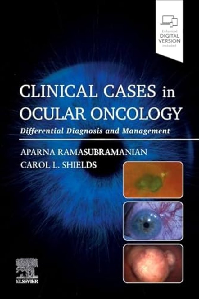 Clinical Cases in Ocular Oncology