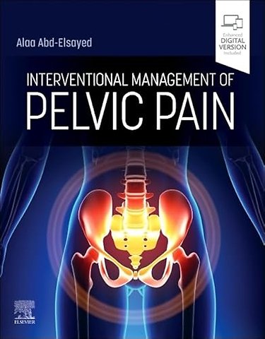 Interventional Management of Pelvic Pain